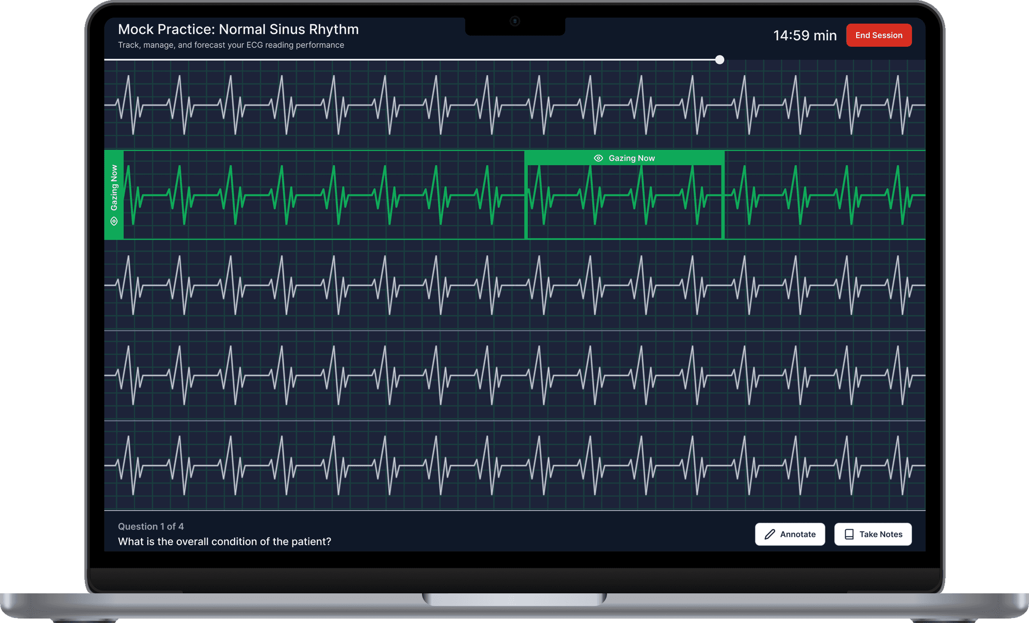eyeTech ECG training platform